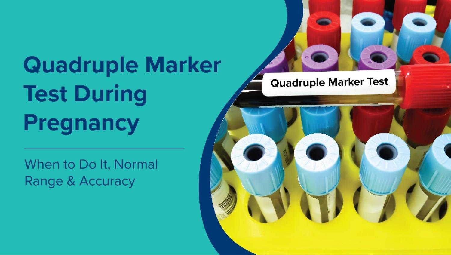 Quadruple Test